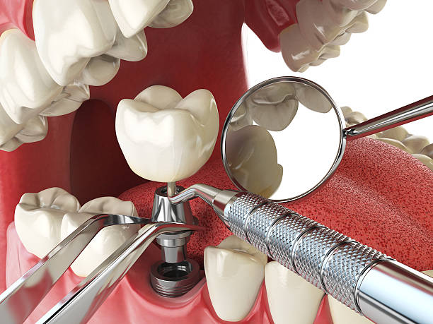 Best Emergency Cosmetic Dentistry in Imperial, NE